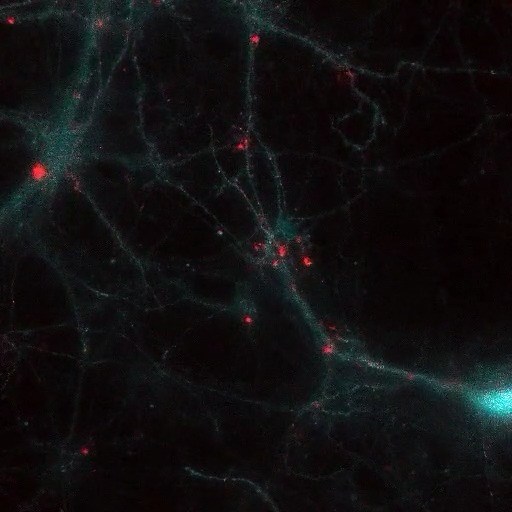 5.7K views · 86 reactions | How do you visualize brain activity? One...