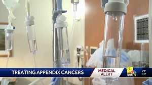 Study shines light on misdiagnosed appendix cancer