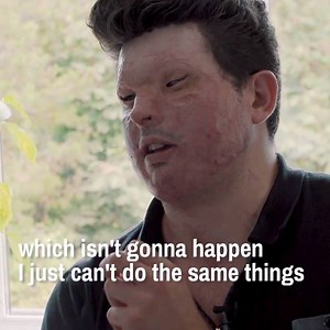 101K views · 381 reactions | This is the horrifying story of a man whose life was changed by an unprovoked acid attack. Credits : UNILAD | Meow! | Facebook