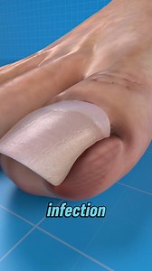 Cutting your nails too short or rounding the edges can cause serious pain, swelling, and even infection. The fix? Trim straight across, it helps your nails grow out naturally without digging into the skin. Avoid the pain. Use the right tool. .#toenailcare #ingrowntoenail #foothealth #nailtips #selfcare #healthtips #shorts #grooming | Mr.BrainBoost