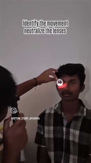 🧠 Retinoscopy Explained Simply Optometry Clinical Skills✅