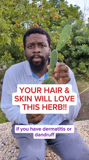 Have you tried soaking Tuna Cactus in Spring Water #TunaCactus #DandruffRemedy #DermatitisRelief #NaturalHairCare #HerbalHealing | Javaun Thompson