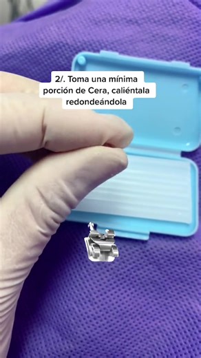 Aprende a usar la Cera Dental 🦷