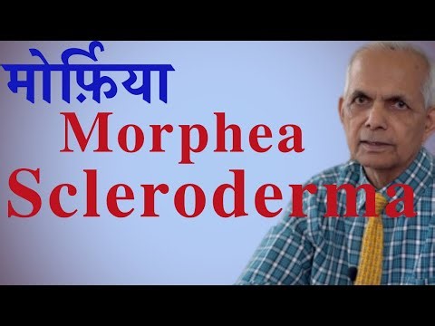 Scleroderma (morphea) symptoms, cause and treatment. मोर्फ़िया के लक्षण कारण और इलाज #scleroderma