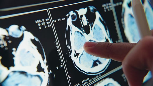 Bachelor of Medicine, Bachelor of Surgery (MBBS) at Hertfordshire Medical School