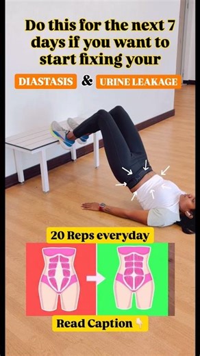 Fix Diastasis Recti & Stop Urine Leakage FAST 🔥 | Must-Do Exercise for Moms