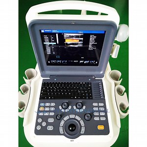 [Hot Item] Portable Cw Cardiac Ultrasound Scanner Digital Color Doppler