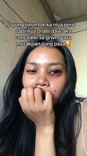 Testing Full Coverage - Concealer GRWM to Hide Bruises