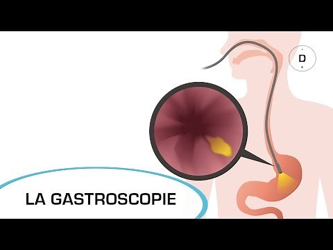Gastroscopy - Medical Examinations