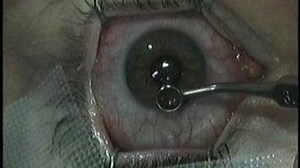 Watch How It's Made Season 1 Episode 20 - Carpets, Drinking Water, Laser Eye Surgery, Acoustic Guitars