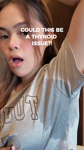 52K views · 176 reactions | Excessive sweating can be caused by hyperhidrosis or an overactive thyroid. If sweating happens with weight loss, shaky hands, or rapid heartbeat, it may be thyroid-related — otherwise, it could be primary hyperhidrosis. #HyperhidrosisAwareness #ThyroidHealth #ExcessiveSweating | Dermadry | Facebook