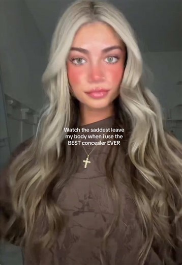 Best Concealer for Acne Around the Mouth