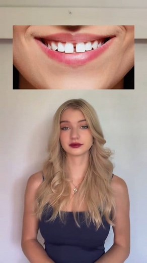 Fun Facts about the Human Body. #HumanAnatomy #DidYouKnow #BodyParts #Diastema #Philtrum | Zars joy