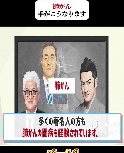 肺がんの意外な初期症状に注意！