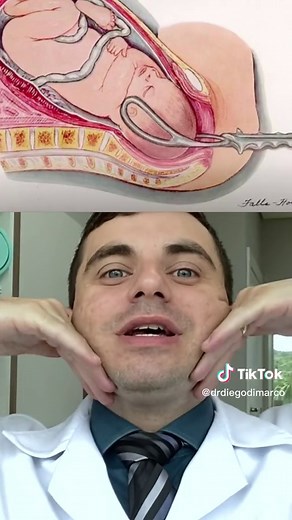 Entendendo o FORCEPS: História e Uso na Obstetrícia