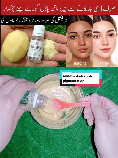 Best Face Masks for Acne and Dark Spot Removal