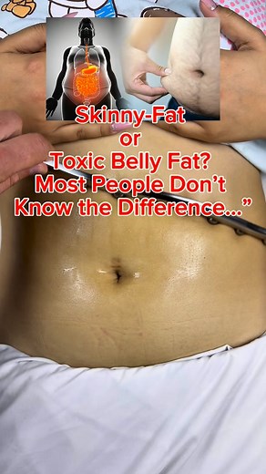 Are You Skinny Fat or Holding Visceral Fat?” Are you “skinny-fat”… or are you secretly carrying DANGEROUS visceral fat around your belly? 🤔🔥 Most people don’t realize this: You can look “normal” in clothes but still be packing TONS of hidden fat wrapped around your organs — the most dangerous fat in the body. 👉 Visceral fat = silent killer. It squeezes your liver, chokes your intestines, slows your metabolism, destroys hormones, triggers inflammation, raises cortisol, and even affects mood, j