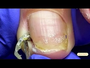 Clean & Calm Nail Trimming – Soft ASMR for Sleep and Comfort