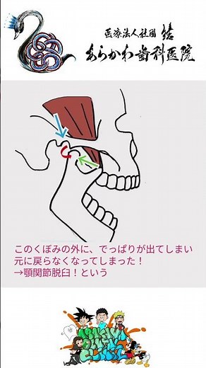 顎が外れた！？どうしよう… #あらかわ歯科医院