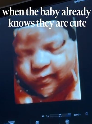 Creating Beautiful Models: Our IVF Journey