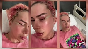 5 Plastic Surgeries That Stunned The World | HOOKED ON THE LOOK