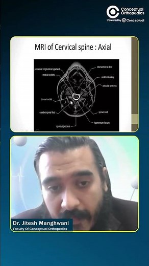 How to Read Axial Cervical Spine MRI | Every Resident Should Know |Dr. Jitesh Manghwani