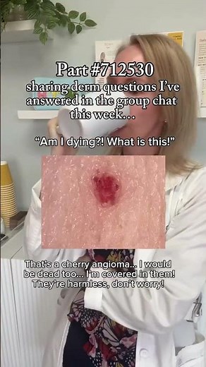 What's a Cherry Angioma?