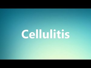 Cellulitis - Medical Meaning and Pronunciation