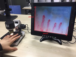 [Hot Item] Blood Capillary Microcirculation Xw880, High Quality Microcirculation Test Machine