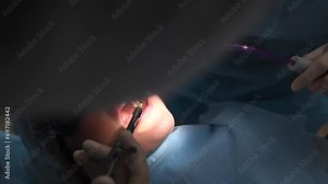 Beautiful Woman in dentist chair at appointment with dental surgeon during wisdom tooth removal and dental care process. 4k 120 fps slow motion cinematic footage