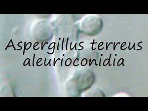 How to pronounce Aspergillus terreus aleurioconidia in English?