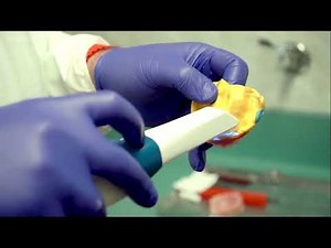 Maxillary Denture intraoral scan impression with AlliedStar 200E