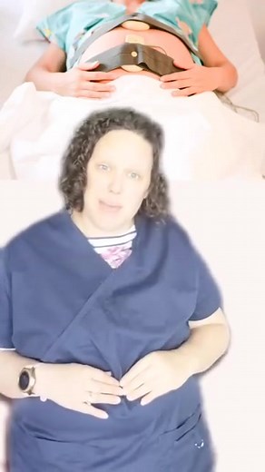 2.3K views | The Contraction Monitor in #laboranddelivery · · · · #MedicalTechnology #HealthcareProfessionals #PregnancyCare #LaborAndDelivery #MedicalInnovation | The Pregnancy Nurse | Facebook