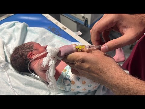 Newborn Baby IV Line Insertion in NICU | Essential Newborn Care 🩺👶