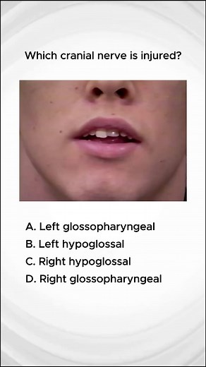 follow for more 🩺 on Instagram: "Answer in poll⤵️"