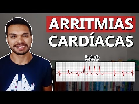 Cardiac Arrhythmias [Cardio 07]