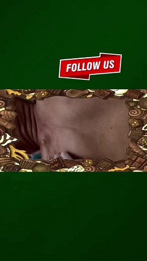 Pimple Satisfying on TikTok