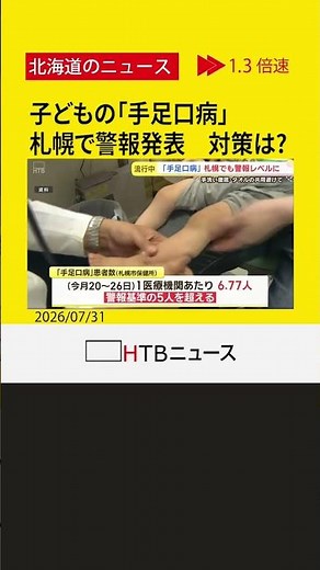 子どもを中心に発症する「手足口病」急増、札幌で警報発表 対策は？