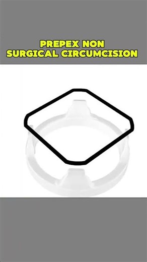 Prepex Non Surgical Circumcision 3d Animated' Disclaimer: This #PrePexcircumcision #NonSurgicalCi...