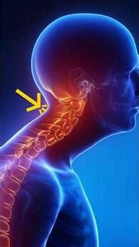 How Bed Posture During Sitting and Sleeping Causes Neck Pain | Easy Explanation 💡 #Shorts
