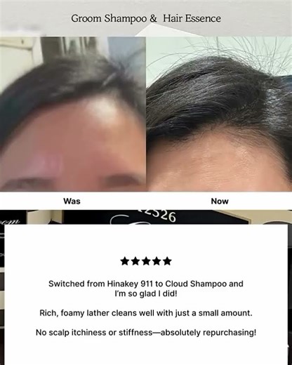 Real Reviews. Real Hair Growth. ☁️ | Blanc Dubu Cloud Shampoo