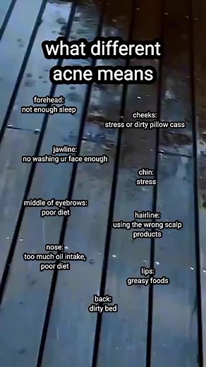 Understanding Your Acne: Tips, Meanings, and Treatment