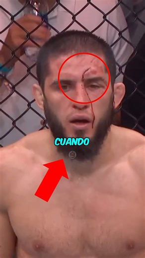 Never Disrespect Your Rival! 💀