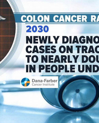 45 is the new 50 when it comes to screening for colon cancer