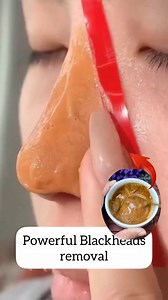 Remove Blackheads From Nose Easily At Home 💯✅ . . . #removeblackheads #ridofblackheads #whiteheads #reelsviralシ #fbreelsfypシ゚ #fbreelsvideo #reelsfypシ #treandingreels #reelsfbシ #reelschallenge #explorepage | Divine Beauty Tips
