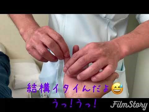 小指の脱臼の治し方リハビリ初日
