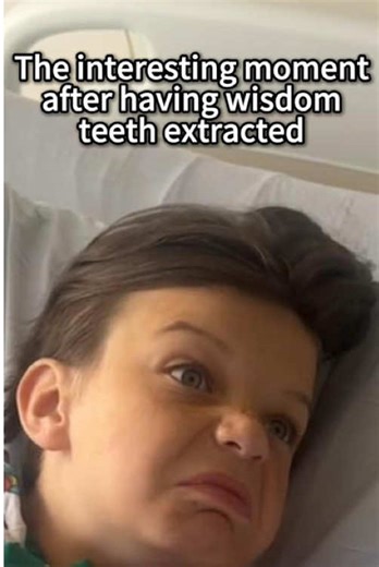 Hilarious Reactions After Wisdom Teeth Extraction