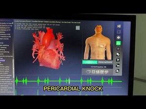 PERICARDIAL KNOCK HEART SOUND