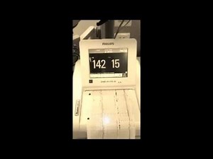 how to use and interpret external fetal monitor