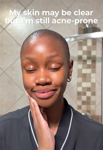 Managing Adult Acne: A Skincare Routine for Clear Skin